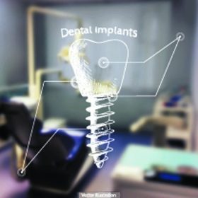 دانلود تصوير برداري سابقه و هدف – عکس تار يک دندانپزشک با طرح – implants implants_002