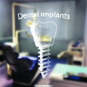 دانلود تصوير برداري سابقه و هدف – عکس تار يک دندانپزشک با طرح – implants implants_001