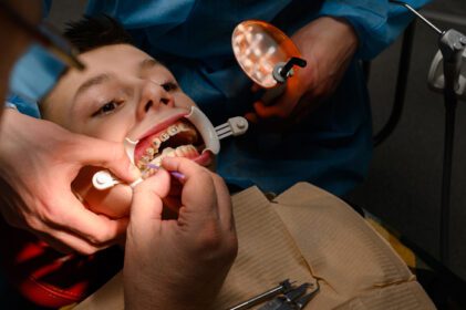 دانلود عکس نوجوان بریس هایی به دندان های بالایی خود چسبانده است