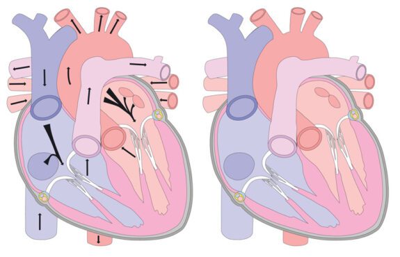 وکتور نقاشی آناتومیک قلب در پس زمینه بخش برای