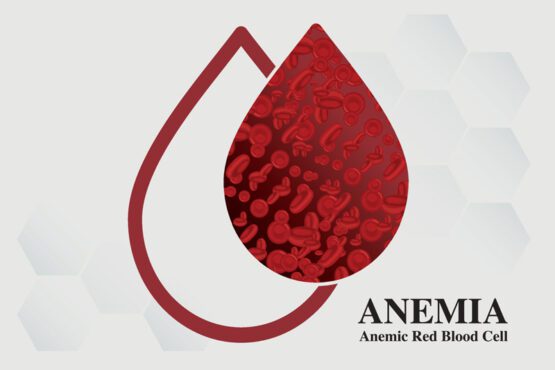 بردار کم خونی آهن گلبول قرمز خون پزشکی وکتور تصویر پزشکی