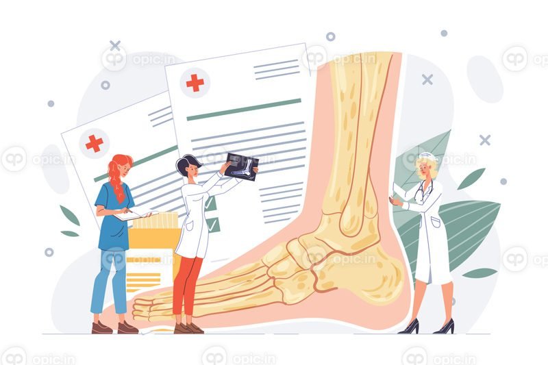 درمان تشخیص رگ به رگ شدن ضربه ناقل پا یا مچ پا