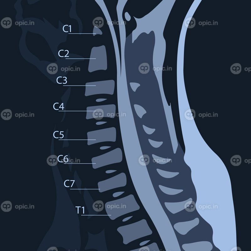 تصویر برداری رزونانس مغناطیسی یا MRI از ستون فقرات گردنی در