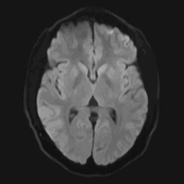 وکتور تصویر محوری واقع گرایانه از مغز مرد با سی تی اسکن MRI