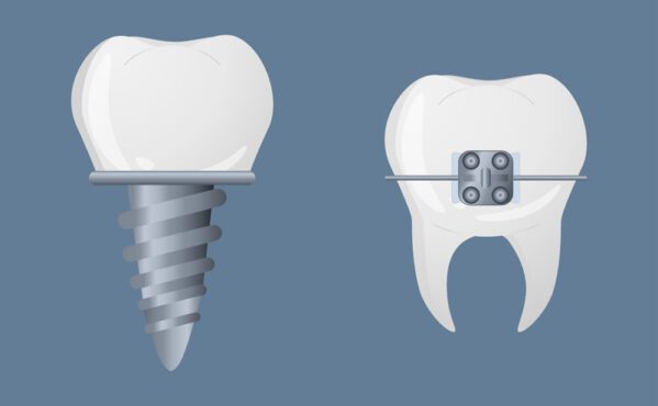 دندان های برداری به سبک واقعی نمادهای جزئیات دندانی رنگارنگ