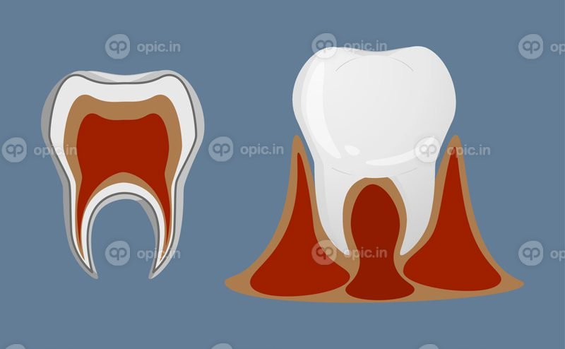 دندان های برداری به سبک واقعی آیکون های آناتومی دندان رنگارنگ