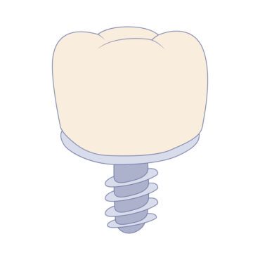 وکتور ایمپلنت دندان به سبک کارتونی نماد