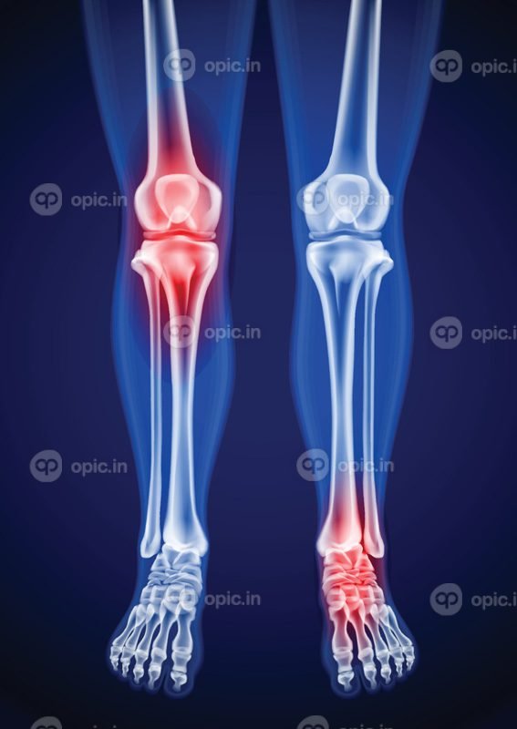 تصاویر وکتور اشعه ایکس از ران های انسان، زانو و پا درد را نشان می دهد